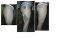 before,week after,2months after